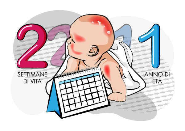 Dermatite seborroica nel neonato